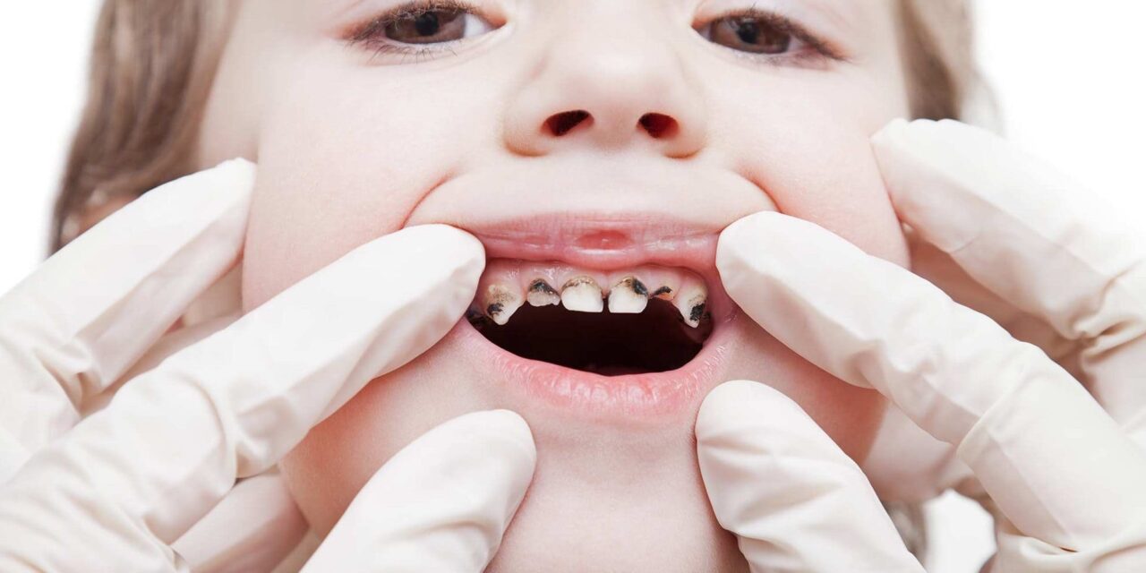 أساسيات العناية بأسنان الأطفال: دليل لفهم أسنان الأطفال*
